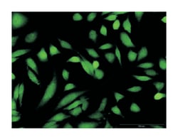 glucokinase (hexokinase 4), Rabbit, Purified MaxPab Polyclonal Antibody,