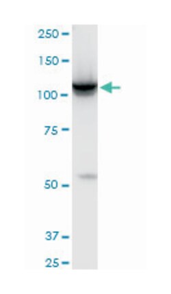 HK2, Mouse, Clone: 4H1, Abnova 100&mu;g; Unlabeled:Antibodies, Monoclonal