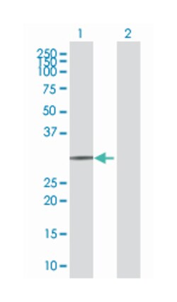 major histocompatibility complex, class II, DO alpha (B01), Mouse anti-Human,