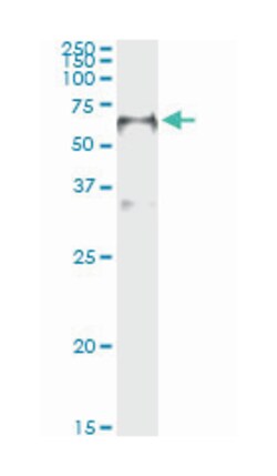 forkhead box A2, Mouse, Clone: 7E6, Abnova 100&mu;g; Unlabeled:Antibodies,