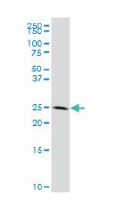 eukaryotic translation initiation factor 6, Mouse, Polyclonal Antibody,