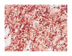 ketohexokinase (fructokinase), Mouse, Clone: 1H6-2B6, Abnova 100&mu;g;