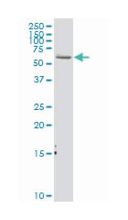 keratin 1, Mouse, Polyclonal Antibody, Abnova&trade;