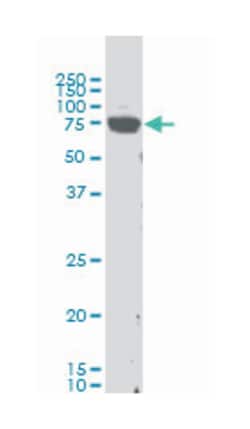 LIMK1, Mouse, Clone: 1B2, Abnova 200 &mu;L | Buy Online | Abnova Corporation | Fisher Scientific
