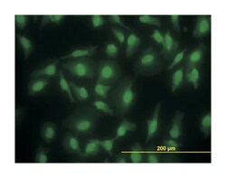 SMAD family member 2, Mouse, Clone: 3G9, Abnova&trade;