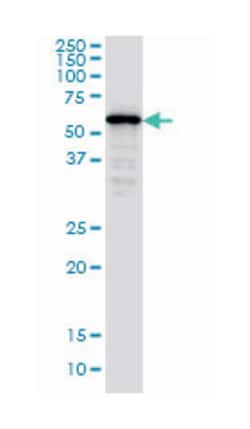 SMAD family member 4, Mouse, Clone: 3E2, Abnova 100&mu;g; Unlabeled:Antibodies,
