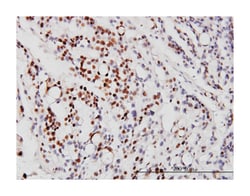 neurogenic differentiation 1, Mouse, Clone: 3H8, Abnova&trade; 100&mu;g; Unlabeled 