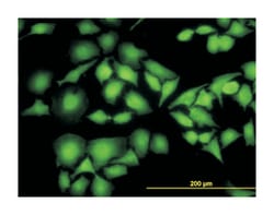 nonmetastatic cells 1, protein (NM23A) expressed in, Mouse, Clone: 1D7,