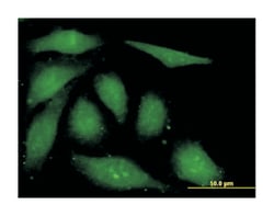 FGF1, Mouse, Clone: 3F5, Abnova 100 &mu;g | Buy Online | Abnova | Fisher Scientific