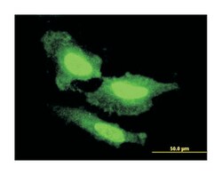 fibroblast growth factor 1 (acidic), Mouse, Clone: 2E12, Abnova 100&mu;g;