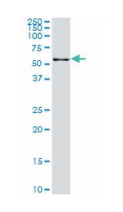 Gardner-Rasheed feline sarcoma viral (v-fgr) oncogene homolog, Mouse, Clone: 3B11, Abnova 100 &mu;g | Buy Online | Abnova | Fisher Scientific
