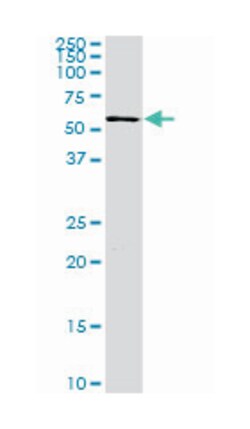 Gardner-Rasheed feline sarcoma viral (v-fgr) oncogene homolog, Mouse, Clone: 3B11, Abnova 100 &mu;g | Buy Online | Abnova | Fisher Scientific