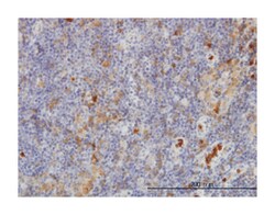 Gardner-Rasheed feline sarcoma viral (v-fgr) oncogene homolog, Mouse, Clone: 3B11, Abnova 100 &mu;g | Buy Online | Abnova | Fisher Scientific