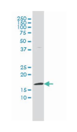 fragile histidine triad gene, Mouse, Clone: 1E3, Abnova 100&mu;g; Unlabeled:Antibodies,