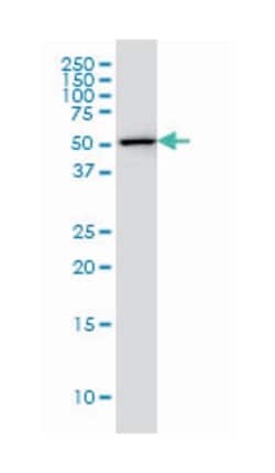 FKBP5, Mouse, Clone: 3D10-1G11, Abnova 100&mu;g; Unlabeled:Antibodies,