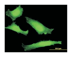 FOXO1A, Mouse, Clone: 1F11, Abnova 100&mu;g; Unlabeled:Anticuerpos