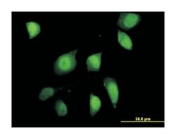 forkhead box O1, Mouse, Clone: 3A10, Abnova&trade;