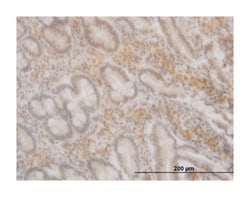 forkhead box O3, Mouse, Clone: 1D2, Abnova 100 &mu;g | Buy Online | Abnova | Fisher Scientific