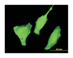 forkhead box O3, Mouse, Clone: 1D2, Abnova 100 &mu;g | Buy Online | Abnova | Fisher Scientific