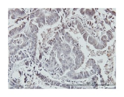 FOXO3A, Mouse, Clone: 4F2, Abnova 100&mu;g; Unlabeled:Antibodies, Monoclonal