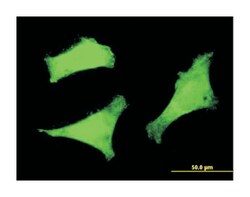 FOXO3A, Mouse, Clone: 4F2, Abnova 100&mu;g; Unlabeled:Antibodies, Monoclonal