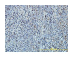 FLNA, Mouse, Clone: 4E10-1B2, Abnova 100&mu;g; Unlabeled:Antibodies, Monoclonal