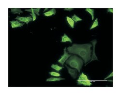 FLNA, Mouse, Clone: 3B6-1D10, Abnova 100 &mu;g | Buy Online | Abnova Corporation | Fisher Scientific