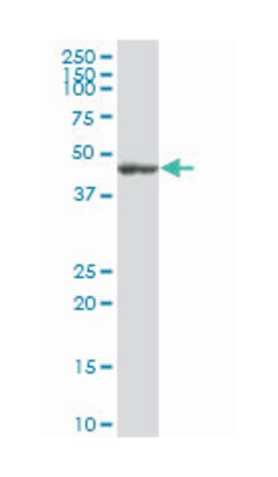 flotillin 2, Mouse, Polyclonal Antibody, Abnova 50 &mu;L | Buy Online | Abnova Corporation | Fisher Scientific
