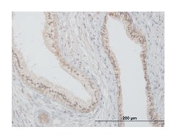 flotillin 2, Mouse, Polyclonal Antibody, Abnova 50 &mu;L | Buy Online | Abnova Corporation | Fisher Scientific