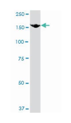 FLT4, Mouse, Clone: 5B5, Abnova 100 &mu;g | Buy Online | Abnova Corporation | Fisher Scientific