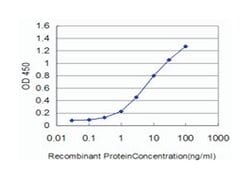 FLT4, Mouse, Clone: 5B5, Abnova 100 &mu;g | Buy Online | Abnova Corporation | Fisher Scientific