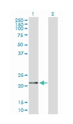 ferritin, heavy polypeptide 1, Rabbit, Polyclonal Antibody, Abnova 100&mu;g;
