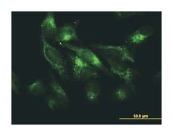 FTL, Mouse, Clone: 1C2, Abnova 100&mu;g; Unlabeled:Antibodies, Monoclonal