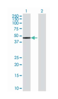 galactokinase 2, Mouse, Polyclonal Antibody, Abnova 50&mu;L; Unlabeled:Antibodies,
