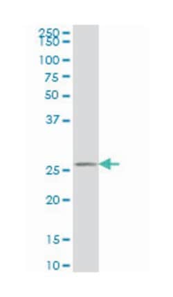 HAGH, Mouse, Clone: 2F9, Abnova 200&mu;L; Unlabeled:Antibodies, Monoclonal
