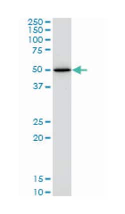 HNF4A, Mouse, Clone: 4E2, Abnova 200&mu;L; Unlabeled:Antibodies, Monoclonal