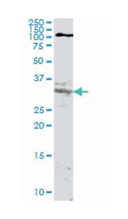 homeobox A11, Mouse, Clone: 8B8, Abnova 100 &mu;g | Buy Online | Abnova Corporation | Fisher Scientific