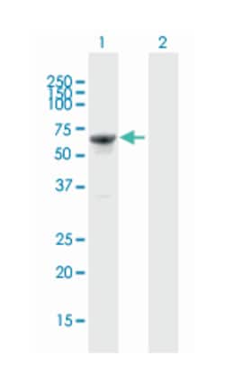 interferon regulatory factor 5, Mouse, Polyclonal Antibody, Abnova 50 &mu;L | Buy Online | Abnova | Fisher Scientific