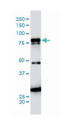 JUP, Mouse, Clone: 2G9, Abnova 200 &mu;L | Buy Online | Abnova Corporation | Fisher Scientific