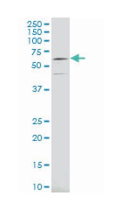 multiple endocrine neoplasia I, Mouse, Polyclonal Antibody, Abnova 50 &mu;L | Buy Online | Abnova Corporation | Fisher Scientific