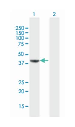 MVD, Mouse, Polyclonal Antibody, Abnova 50&mu;g; Unlabeled:Antibodies,