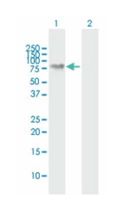NEFL, Rabbit, MaxPab Polyclonal Antibody, Abnova 100&mu;L; Unlabeled:Antibodies,