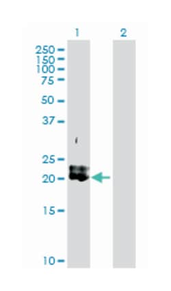 platelet-derived growth factor alpha polypeptide, Rabbit, Purified MaxPab