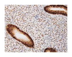 progesterone receptor, Mouse, Clone: 2C2, Abnova 100&mu;g; Unlabeled:Antibodies,