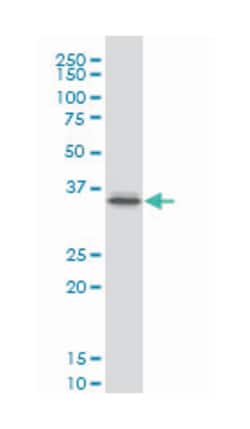 paired-like homeodomain 1, Mouse, Clone: 6D4, Abnova 100&mu;g; Unlabeled:Antibodies,