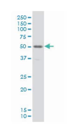 PBX/knotted 1 homeobox 1, Mouse, Clone: 4F6, Abnova 100&mu;g; Unlabeled:Antibodies,