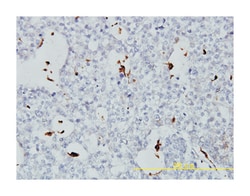 phospholipid transfer protein, Mouse, Clone: 2F3-G4, Abnova™