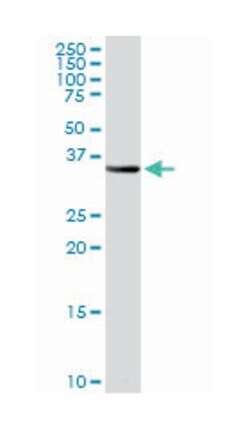 proteasome (prosome, macropain) subunit, beta type, 8 (large multifunctional