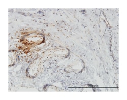 twinfilin, actin-binding protein, homolog 1 (Drosophila), Mouse, Clone: