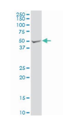 ribonuclease/angiogenin inhibitor 1, Mouse, Polyclonal Antibody, Abnova 50 &mu;L | Buy Online | Abnova Corporation | Fisher Scientific